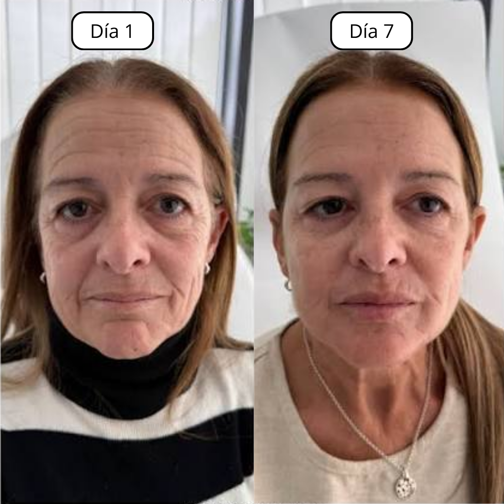 Linfa™ | Cepillo Facial para Drenaje Linfático