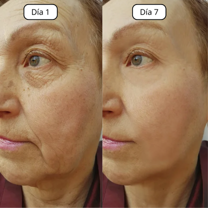 Linfa™ | Cepillo Facial para Drenaje Linfático